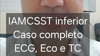 Infarto do Miocárdio - caso completo