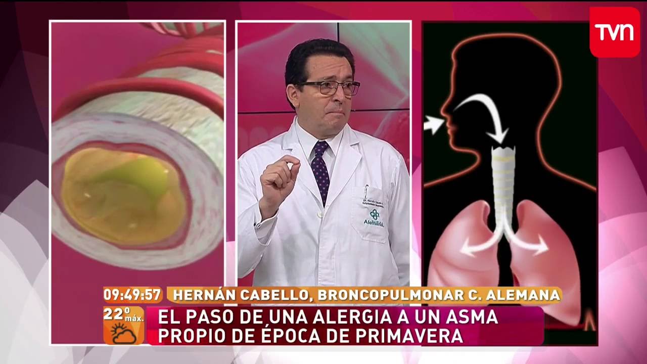 Giovanni Alvear Urzua-28