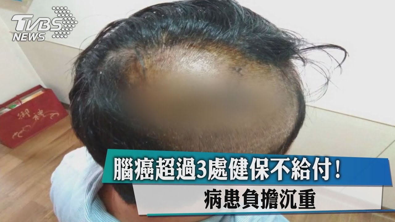 腦癌超過3處健保不給付! 病患負擔沉重