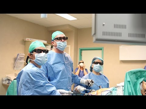 Chirurgie laparoscopică SASI-S Dr. Kevin Dolan Perth