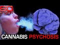 The Chilling Truth About Cannabis Psychosis 60 Minutes Australia