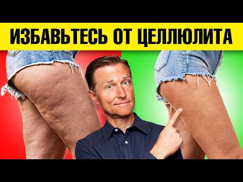 Как убрать целлюлит на ягодицах и бедрах! ЭТО работает🔥