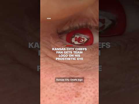 Kansas City Chiefs fan gets team logo on his prosthetic eye