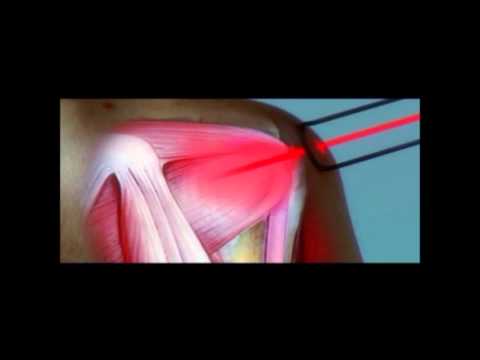 Norbekovu per il trattamento di ginnastica della colonna vertebrale Una diagnosi che fa male alla vita