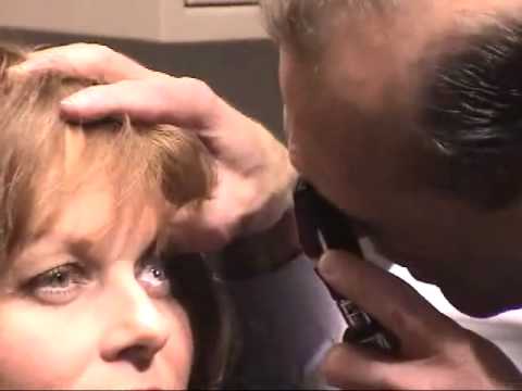 Direct Ophthalmoscopy