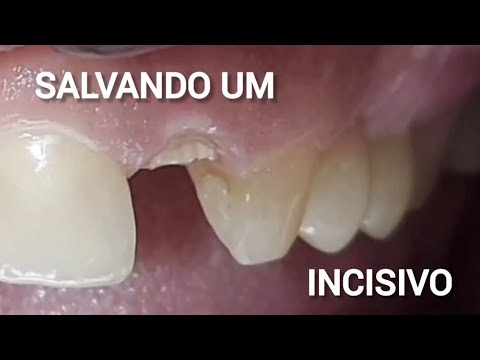Marcelo Emanoel-50
