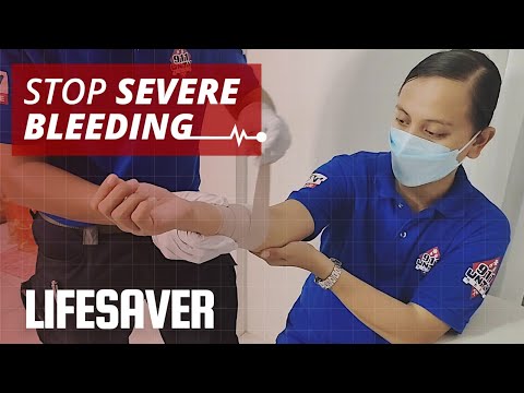 How to Stop Severe Bleeding | LIFESAVER