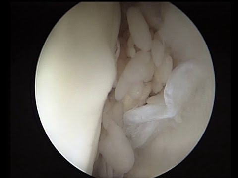 Osteocondrosi profilassi clinica trattamento Una serie di esercizi per lo sviluppo della mobilità articolare