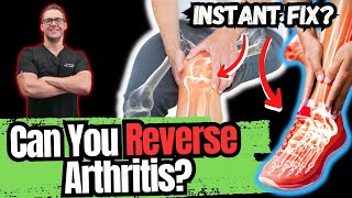 BEST 5 Ways to STOP Arthritis Pain [Big 2023 New SECRETS!]