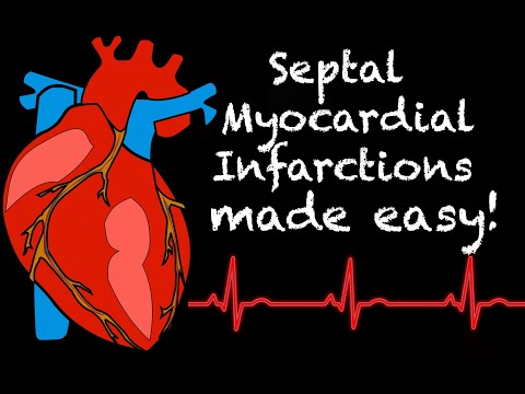 EMS Cardiology || Tachy Tuesday: Septal Myocardial Infarctions in EMS