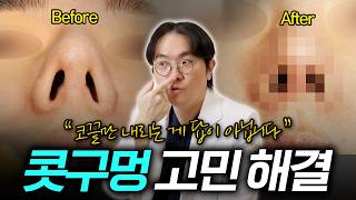 EDITION TV - 콧구멍이 정면에서 너무 보인다고요? 일단 들어오세요