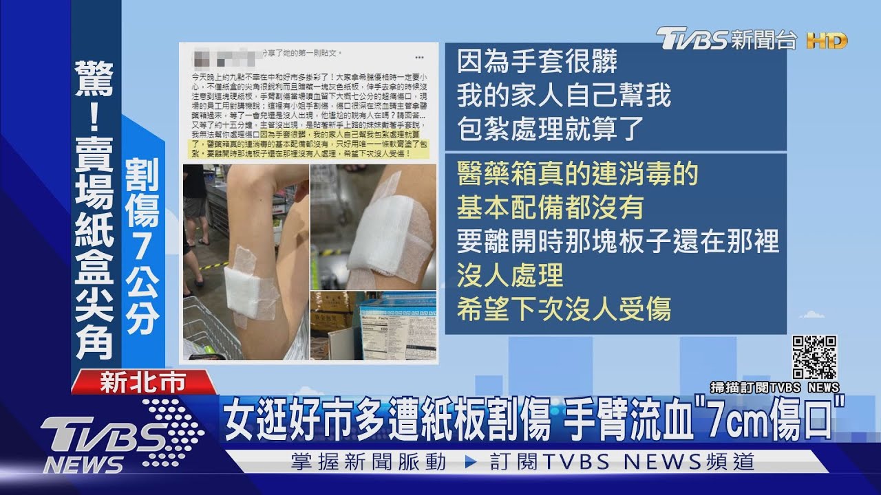 女逛好市多遭紙板割傷 手臂流血「7cm傷口」