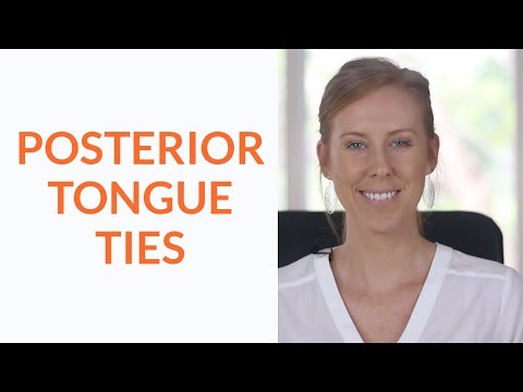 What is A Posterior Tongue Tie?
