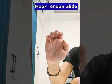 Trigger Finger Pain? Try These Easy Exercises for Fast Relief!