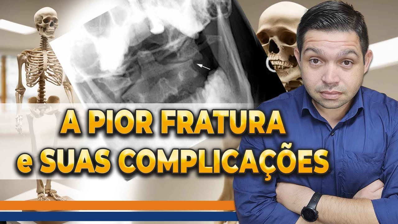 PIOR FRATURA DE TODAS e o GRANDE RISCO DE QUEM TEM