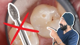How to Place Posterior Composites without Destroying Your Anatomy - PDP200