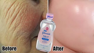 Baby oil is a million times stronger than Botox, eliminate deep wrinkles and fine lines