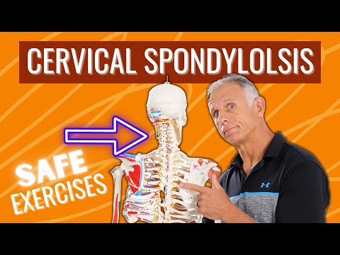 Cervical Spondylosis (DJD)—NEVER DO THIS, DO This Protocol for safe relief. (Over 50)