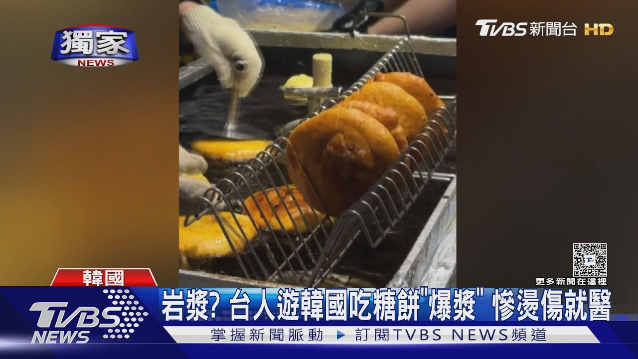 根本岩漿？　台人遊韓國吃糖餅「大爆漿」　慘燙傷就醫