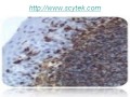 Orcein Stain Kit (For Hepatitis B and Elastic Fibers) HBK2 ( Histology, Special Stai...