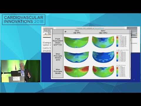 CVI2018 Session: Deficiencies in TAVR science - where do we need to go? - David Brown, MD