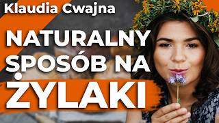 Masz problem z ŻYLAKAMI? Wyleczysz je sama! Natura daje rozwiązania