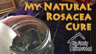 My Natural Rosacea Treatment