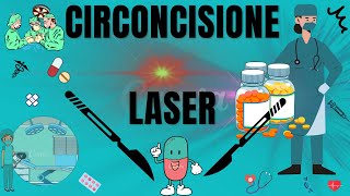 Circoncisione laser