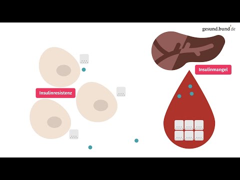 Was ist Typ-2-Diabetes?