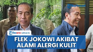 Ajudan Jokowi Buka Suara Usai Flek Hitam Wajah & Leher Presiden ke-7 RI Disorot: Beliau Alergi Kulit
