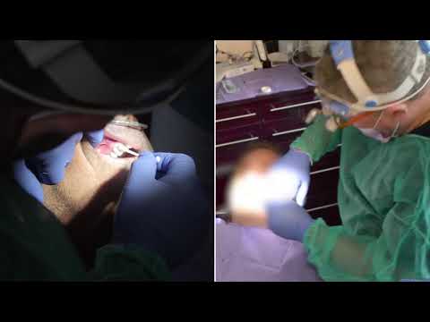 GlamourDent clip1 30s