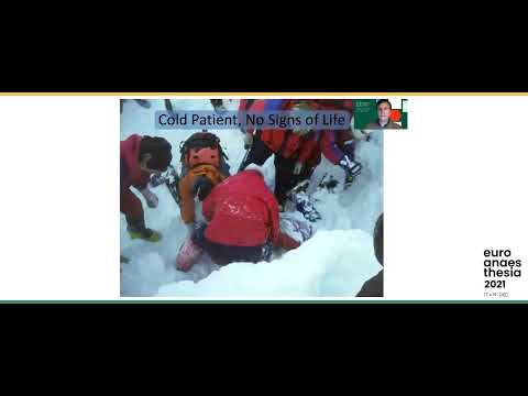 Management of cardiac arrest: focus on hypothermic patients