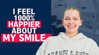 Invisalign Teeth Straightening Experience