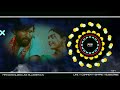 Saami Saami Pushpa Telugu Dj Edm Trance Mix Dj Dinna Alls Remix