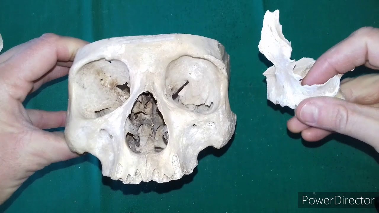 TP N° 20 Regiones comunes al cráneo y a la cara  Dr  Luciano Esborrat