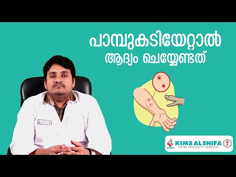 പാമ്പുകടിയേറ്റാൽ ആദ്യം ചെയ്യേണ്ടത് | Snake Bite KIMS Alshifa Perinthalmannna