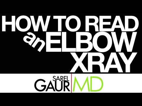 How to Read an Elbow X-ray