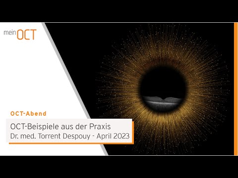 OCT-Abend 04/2023 - OCT-Beispiele aus der Praxis