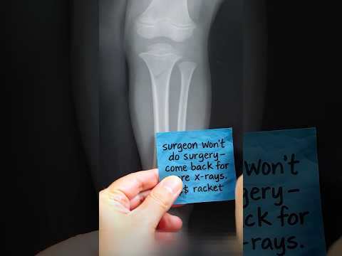 When Doctors Refuse To Fix Your Kid’s Broken Bone⁉️ #shorts