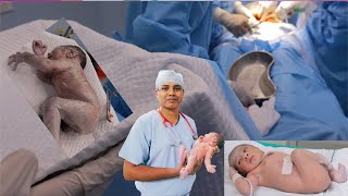 Newborn Baby First 5 Minutes After Birth | जन्म के बाद नवजात शिशु के साथ क्या क्या होता है