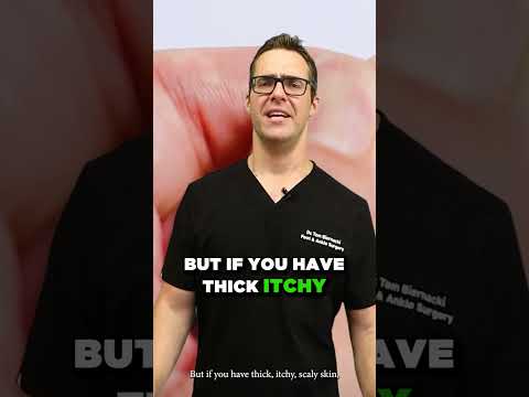 Best Varicose Vein Home Treatments Top 25 Spider Veins Remedies