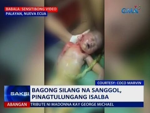 Na nagbigay ng kapanganakan sa higit pang mga timbang kung pagkatapos ang nawalang timbang Mawalan ng timbang sa tulong ng mga thread