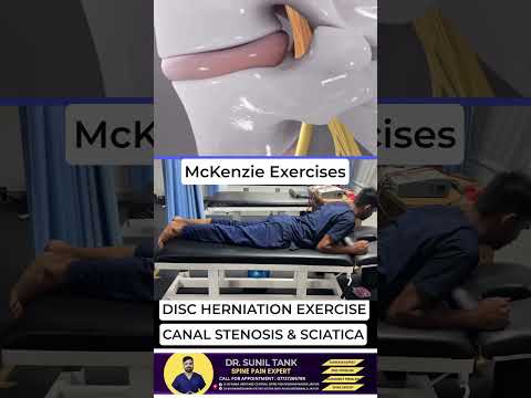 Best exercise for L4-L5 disc herniation #drsuniltank #physiopoint #backpain #jaipur #sciatica