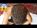 Remove lice on sad boy's head #003
