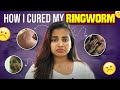 My Severe Skin Allergy Update Ringworm வந்தா இத பண்ணுங்க Keerthi Shrat