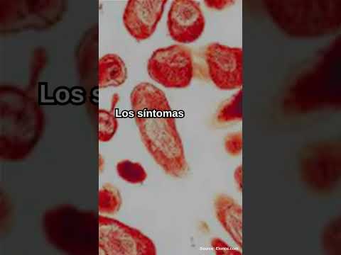 Fiebre Q en Entre Ríos: qué es, cuáles son los principales síntomas y