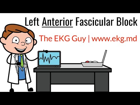 Left Anterior Fascicular Block on EKG / ECG l The EKG Guy - www.ekg.md