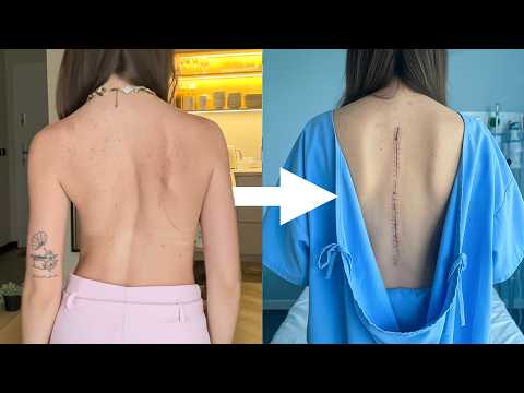 To Był Najgorszy Ból w Moim Życiu… OPERACJA KRĘGOSŁUPA (2/2)