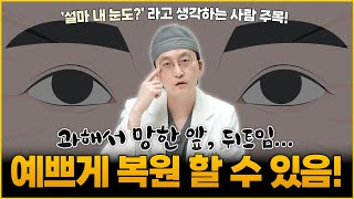 트임수술, 복원할 수 있을까? 꼭 알아야 할 케이스별 진실