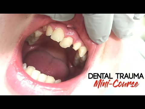Urazy w stomatologii - mini kurs - część 1 - wstęp